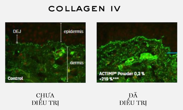 1 bước trước thời gian với kem dưỡng 300-Peptide Rénergie từ Lancôme Kem dưỡng 300-Peptide Rénergie