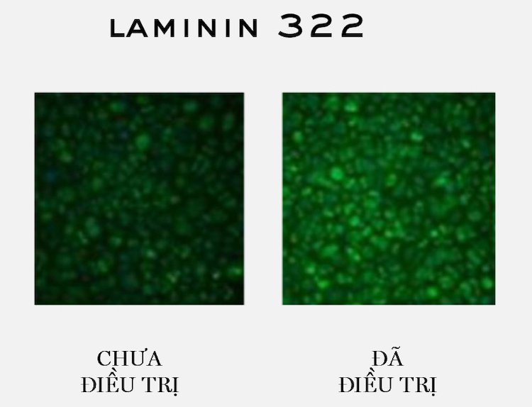 1 bước trước thời gian với kem dưỡng 300-Peptide Rénergie từ Lancôme kem duong Lancome 300 Peptide 04